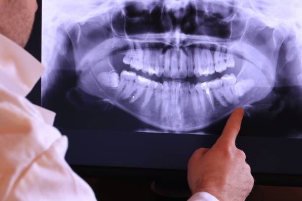 Best Broken or Cracked Tooth Emergency Dentist in Channel Lake, IL